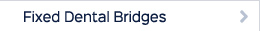 Fixed Dental Bridges