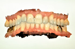 DIGITAL INTRAORAL SCANNER